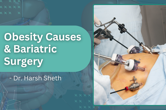 Obesity Causes Bariatric Surgery