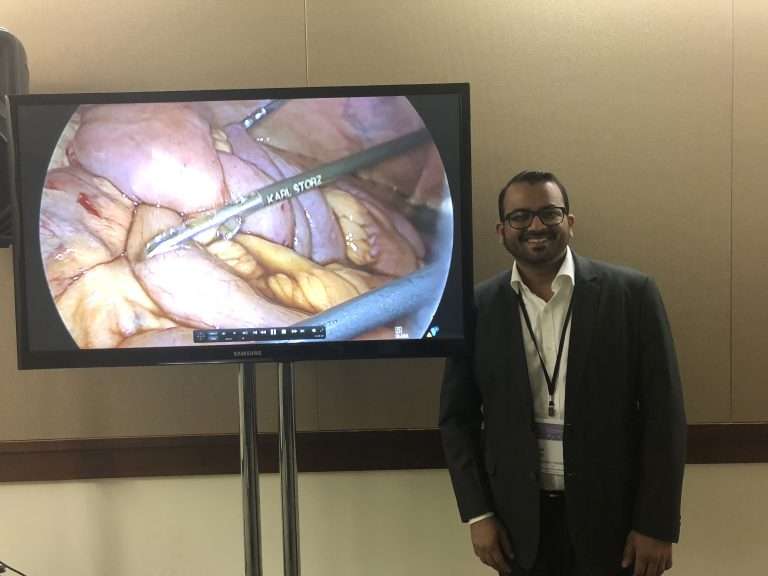 video presentation at the prestigious SAGES confernce 2018, Seattle, USA