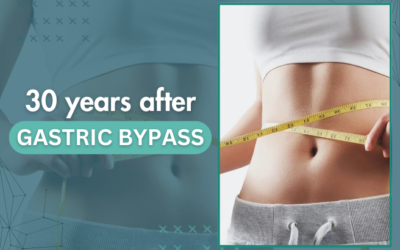 30 years after gastric bypass