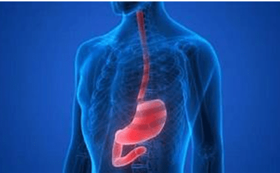 Achalasia – All you need to know