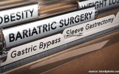 Bariatric Surgery-Myths and Facts