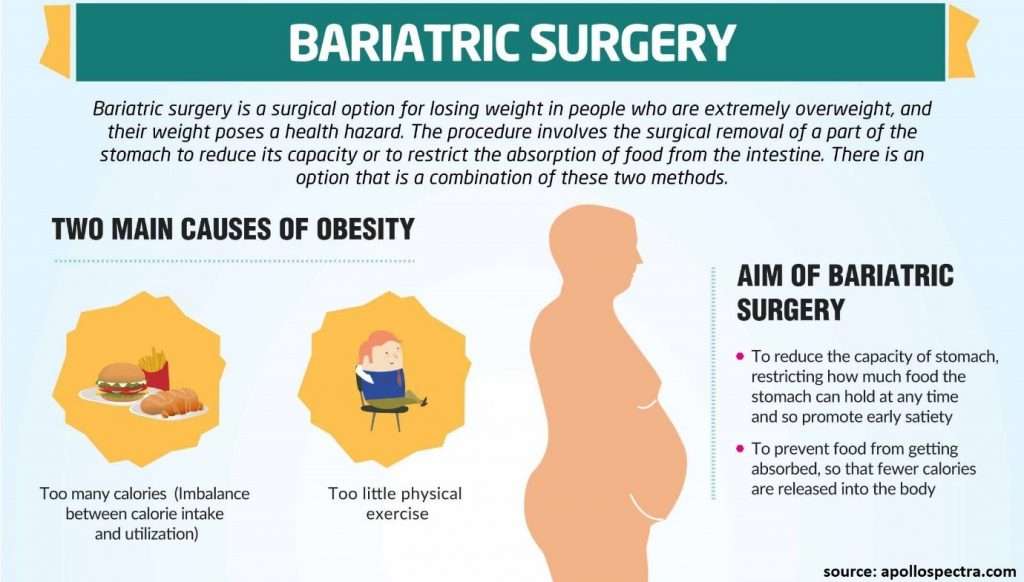Bariatric-Surgery-Helps-1024x582
