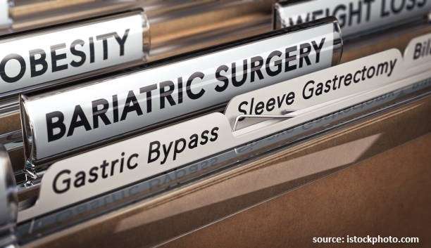 Bariatric-Surgery