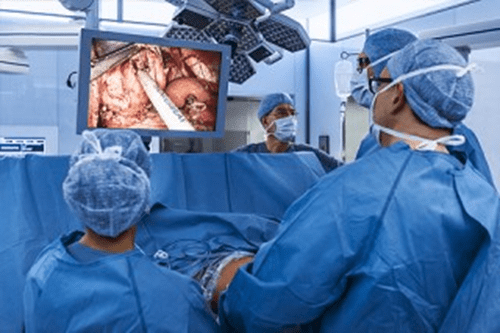 evolution of laparoscopic surgical