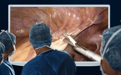 Evolution of laparoscopic surgical equipment to aid faster surgery with better outcomes