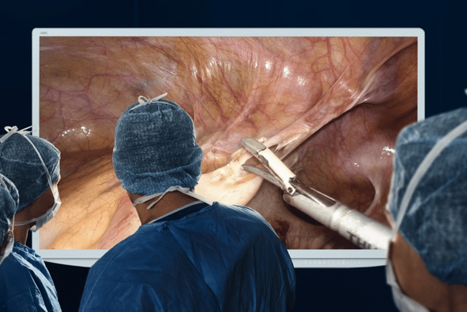 Evolution of laparoscopic surgical