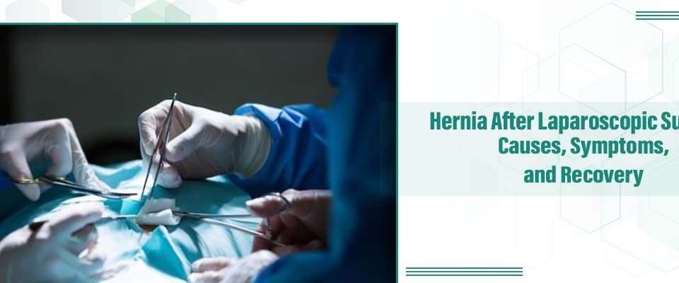 Hernia After Laparoscopic Surgery