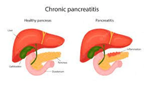 Pancreatic duct