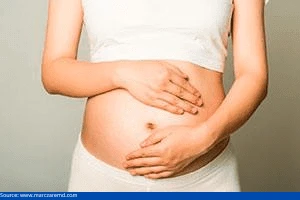 Postpartum Hernia