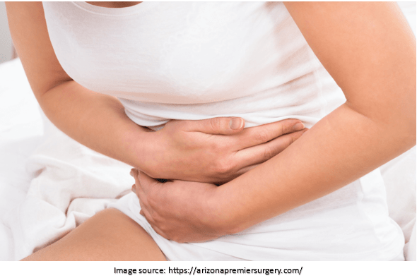 Why Remove Gallbladder Instead of Stones