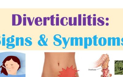 Everything you Need to Know About Diverticulitis