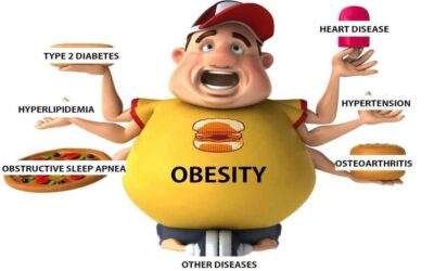 Impacts of obesity on your body and health