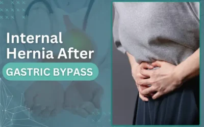 Internal Hernia After Gastric Bypass