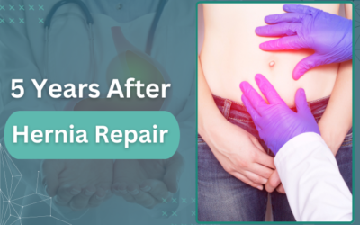 5 Years After Hernia Repair: Recovery, Results, and Long-Term Care