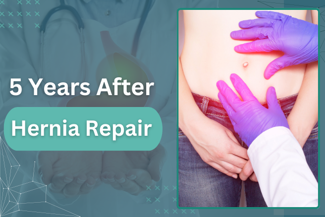 5 Years After Hernia Repair: Recovery, Results, and Long-Term Care