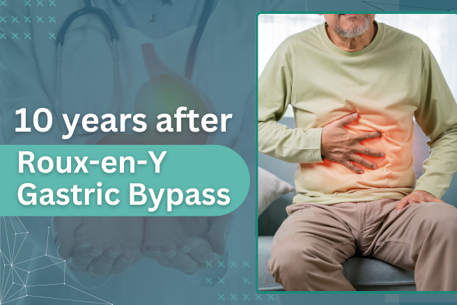 10 Years After Roux-en-Y Gastric Bypass: Long-Term Benefits & Challenges