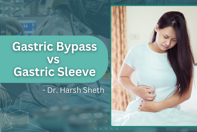 Gastric Bypass vs Gastric Sleeve