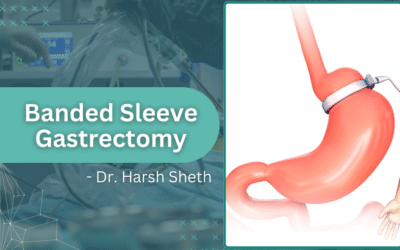 Banded Sleeve Gastrectomy