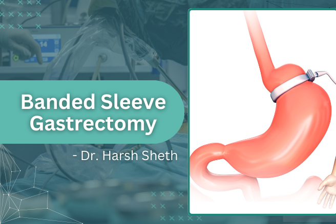 Banded Sleeve Gastrectomy