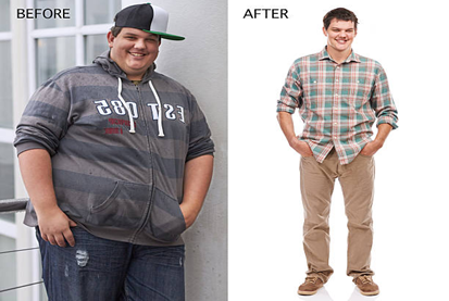What Lifestyle or Dietary Changes Can Help Reverse Post-Bypass Weight Gain?