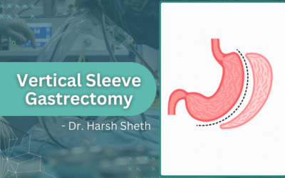 Vertical Sleeve Gastrectomy in Mumbai: Procedure, Recovery, and Results