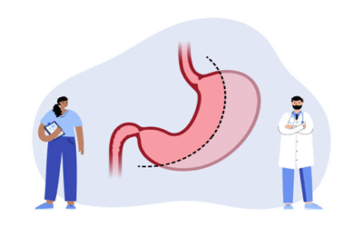 Laparoscopic Gastric Sleeve Surgery in Mumbai