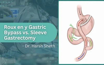 Roux-en-Y Gastric Bypass vs. Sleeve Gastrectomy: A Comprehensive Comparison