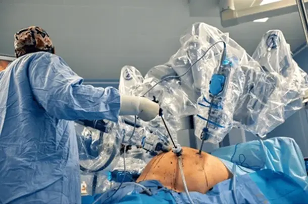 When Should Someone Consider Robotic GI Surgery?