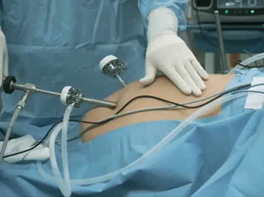 Conventional Surgery