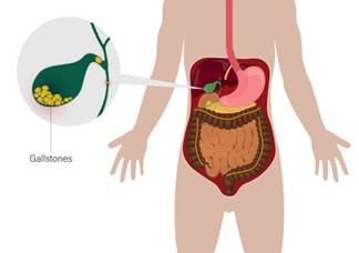Possible Benefits of Robotic GI Surgery
