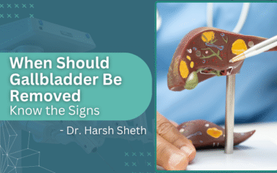 When Should Gallbladder Be Removed?