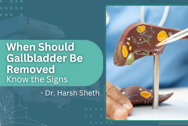 When Should Gallbladder Be Removed Banner
