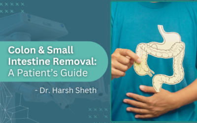 Removal of Colon and Small Intestine: Symptoms, Treatment Options, and Long-Term Outcomes