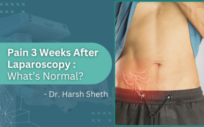 Is pain 3 weeks after laparoscopy normal?