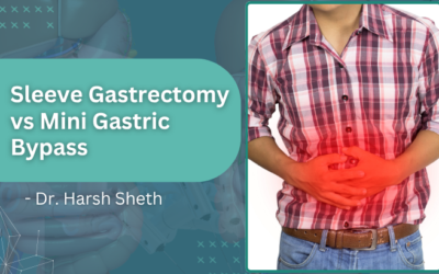 Sleeve Gastrectomy vs Mini Gastric Bypass Which One Is Right for You?