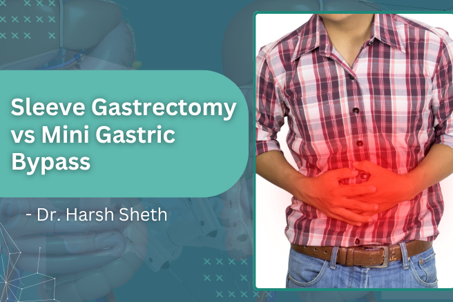 Sleeve Gastrectomy vs Mini Gastric Bypass