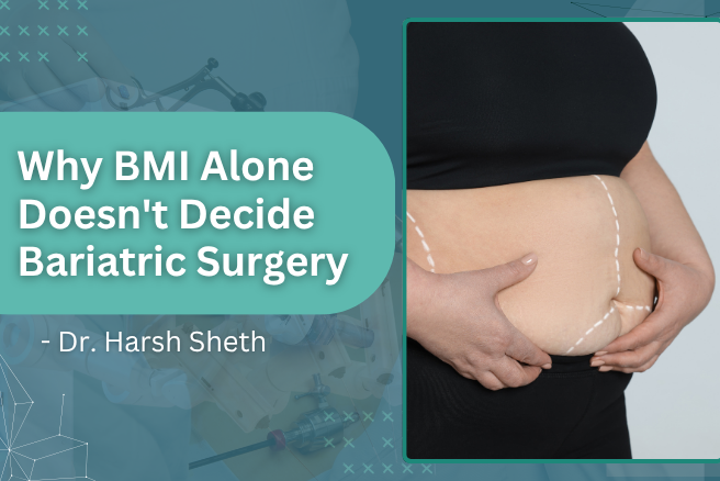 Why BMI Alone Doesnt Decide Bariatric Surgery