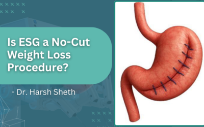 Is ESG a No-Cut Weight Loss Procedure