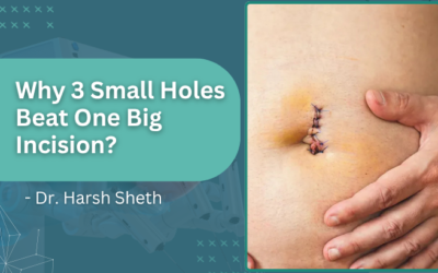 Why 3 Small Holes Beat One Big Incision?