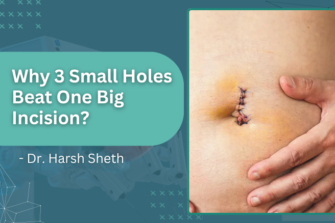 Why 3 Small Holes Beat One Big Incision?