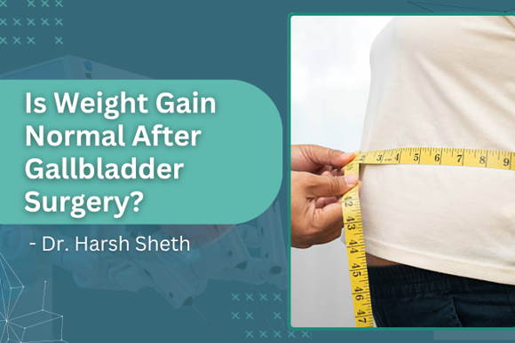 Banner: Is weight gain normal after gallbladder surgery? by Dr. Harsh Sheth; shows a person measuring their waist with a tape measure.