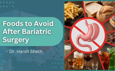 Which Foods Should You Avoid After Bariatric Surgery?