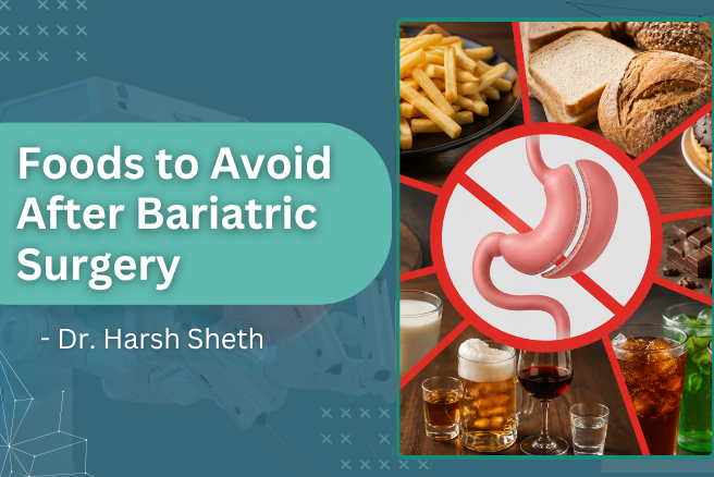 Which Foods Should You Avoid After Bariatric Surgery?
