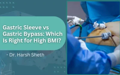 Gastric Sleeve vs Gastric Bypass: Which Is Right for High BMI?