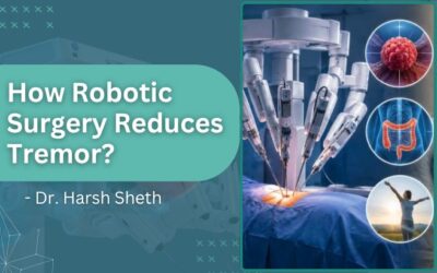 How Robotic Surgery Reduces Tremor in Complex GI Procedures
